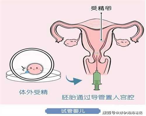 试管婴儿成人之后会出现哪些问题_泰国试管婴儿移植后会出现哪些问题
