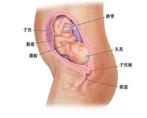 代生儿子：怀孕初期腰疼怎么缓解