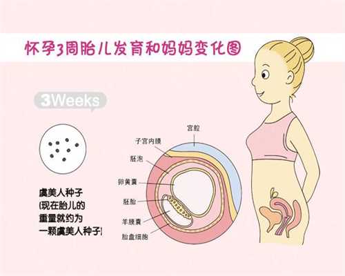 美国试管婴儿：服用促排卵药会引起腹部积水吗？