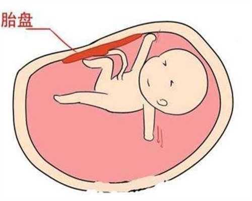 杭州做试管婴儿有哪些医院？