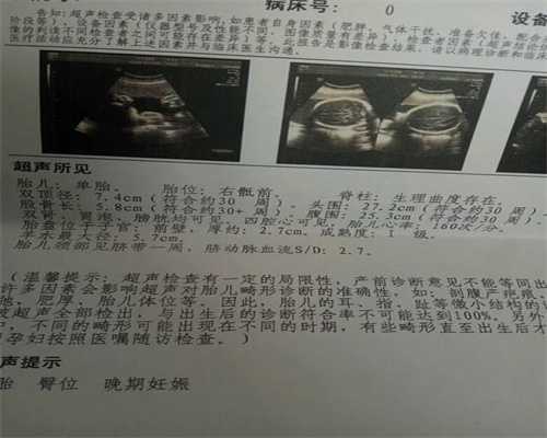 泰国试管婴儿移植后几个行为会致使胎儿畸形