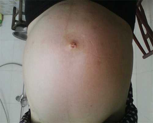 重庆卵巢早衰能通过泰国试管婴儿助孕吗？